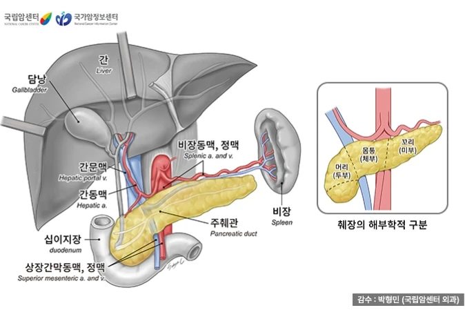 생존율 낮은 췌장암, 등 아프거나 갑자기 당뇨 오면 신호